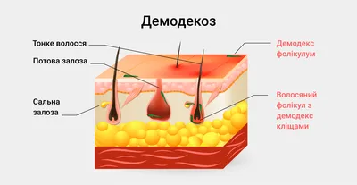 4. Откройте тайны: Фотографии демодекоза человека