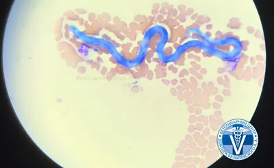 Изображения дирофиляриоза у человека: картинки для скачивания