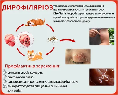 Человек с дирофиляриозом: фото для загрузки