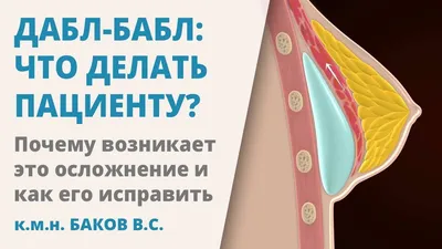 Завораживающий эффект водопада после маммопластики на фото: Искусство создания идеального силуэта