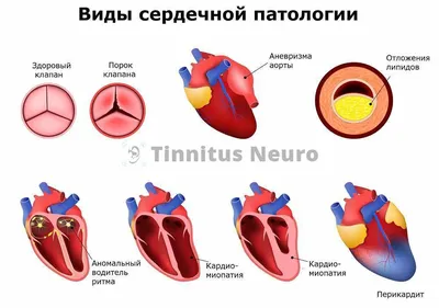 ЭКГ человека: изображение в PNG для скачивания