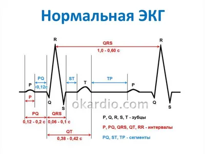 Изображение ЭКГ здоровья в высоком разрешении (JPG)