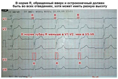 ЭКГ человека: PNG фото для вашего выбора