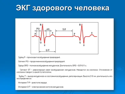 Фотография ЭКГ человека: выберите размер (WebP)