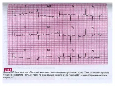 Изображение ЭКГ: скачать в формате JPG