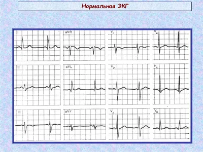 Фотография ЭКГ: JPG формат для вашего выбора