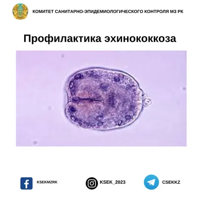 Изображения эхинококкоза: выбор формата – JPG, PNG, WebP