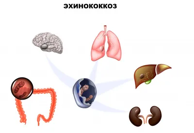 Эхинококкоз у человека: разнообразные форматы и размеры фото