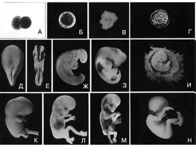 Картинка эмбриона человека на 10 недель для скачивания в PNG