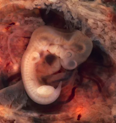 Эмбрион человека  фото