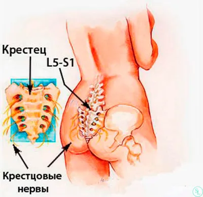 Человеческий крестец в фокусе: Выбор размера и формата фотографии