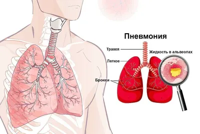 Бронхи в деталях: фотографии с возможностью выбора размера