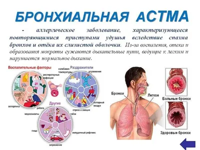 Фотографии бронхов человека: определите размер и формат перед загрузкой