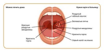 5. Внутренний Мир Человеческого Организма: Фото Гланд на Ваш Выбор