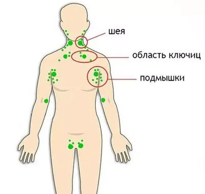 Где находятся лимфоузлы у человека на шее фотографии