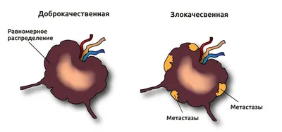 Фото лимфатических узлов на шее: изображение в WebP