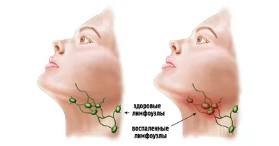 Изображение лимфатических узлов на шее: PNG для скачивания