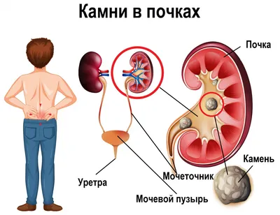 Анатомия человеческих почек на картинках