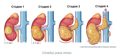 Изображения анатомии почек с возможностью скачивания в различных форматах