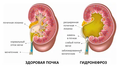 Фотографии человеческих почек: выберите размер и формат