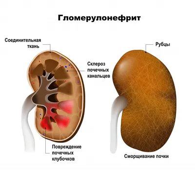 Анатомия человеческих почек: выбор формата и размера фото