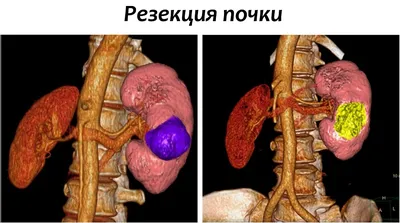 Фотографии человеческих почек: скачивание в JPG, PNG, WebP