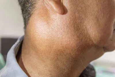 Где расположены слюнные железы? Фотогалерея с различными настройками