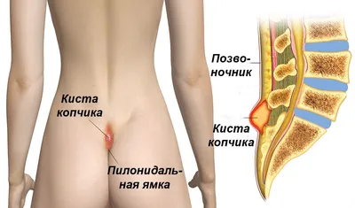 Копчик у человека: Изображение с возможностью выбора формата (JPG, PNG, WebP)