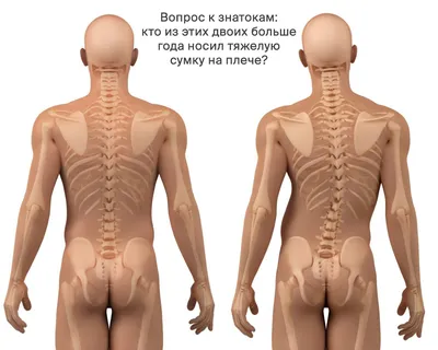 Фото копчика: Выберите формат изображения - PNG, WebP