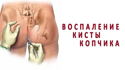 Фото копчика человека: Выберите свой идеальный размер изображения