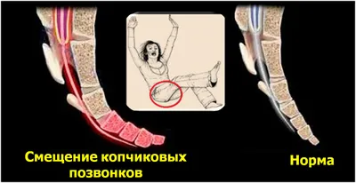 Копчик человека: Фото с возможностью выбора размера и формата
