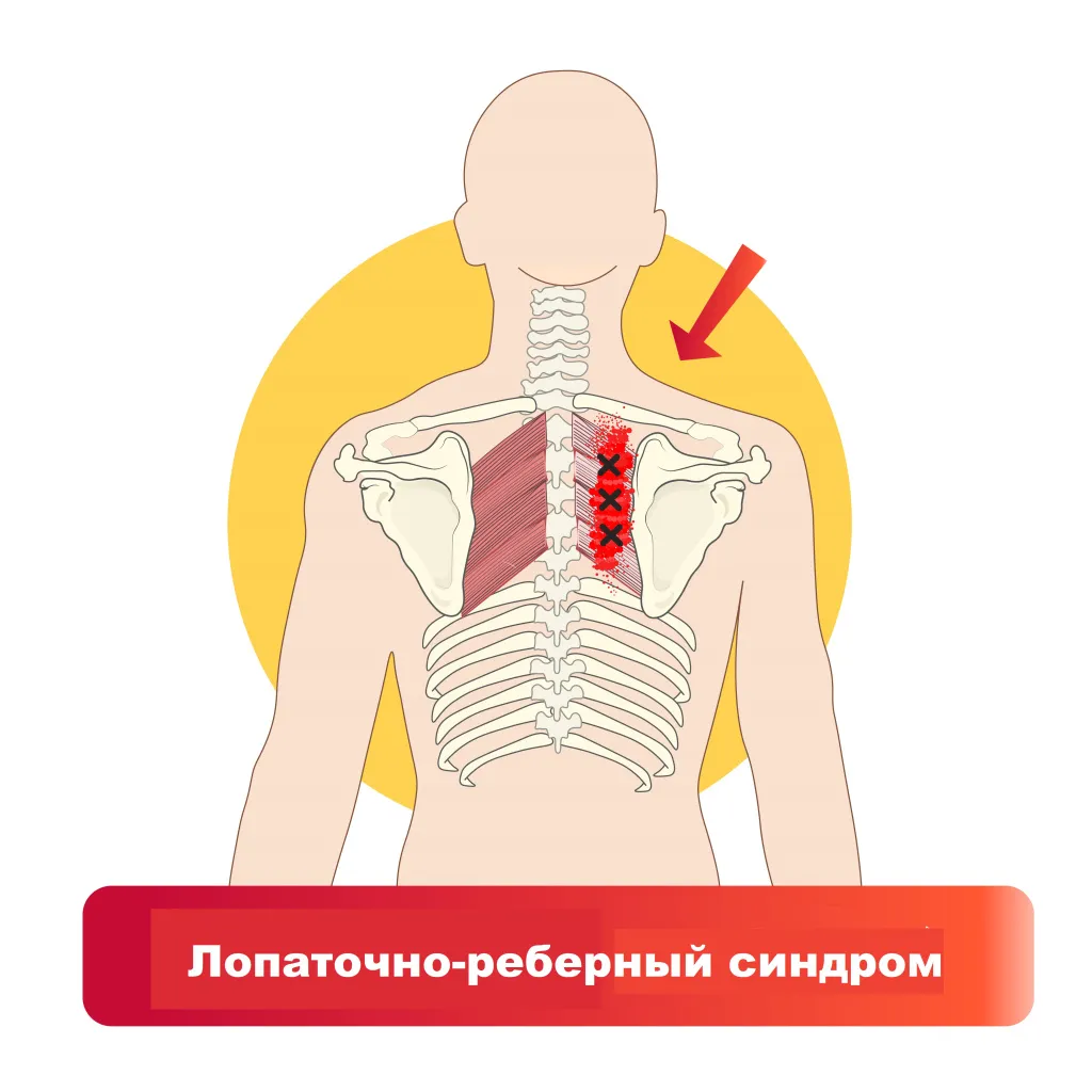 Анатомия мышц плечевого пояса. Точки крепления. Силовые упражнения.