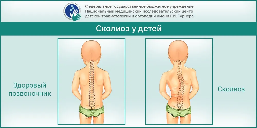 Подробный разбор квадратной мышцы поясницы для фитнес-тренеров