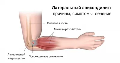 Анатомия предплечья: фотографии в различных форматах