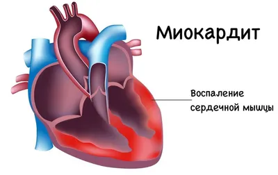 30. Великолепие сердца: Фото в разнообразных форматах