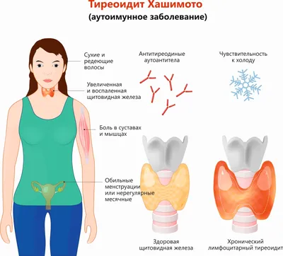 Человеческая щитовидка: скачайте изображение в JPG, PNG, WebP