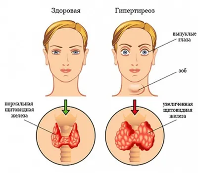 Человеческое тело в деталях: изображение щитовидной железы