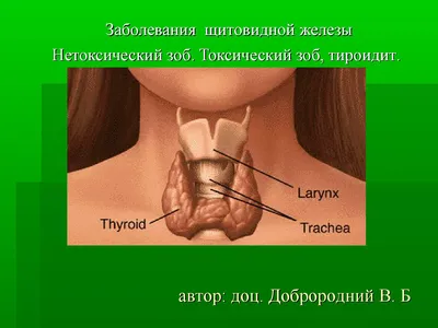 Анатомия в фокусе: фото щитовидной железы на выбор