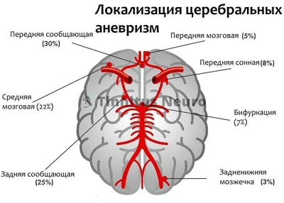 Загадочное местоположение: Сонная артерия на изображении