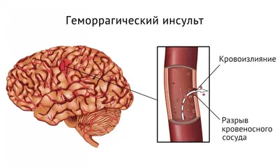 Фотография с сонной артерией: Подробное изображение анатомии