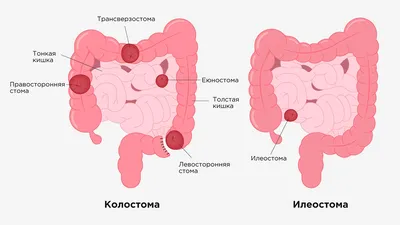 Фото толстой кишки человека: выберите размер (JPG)