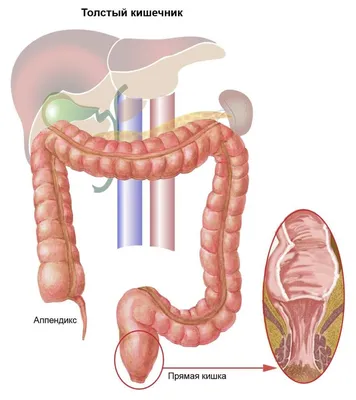 Картина толстой кишки у человека (JPG)