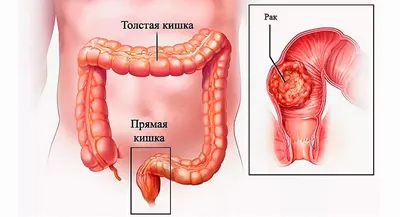 Изображение анатомии толстой кишки человека (JPG)