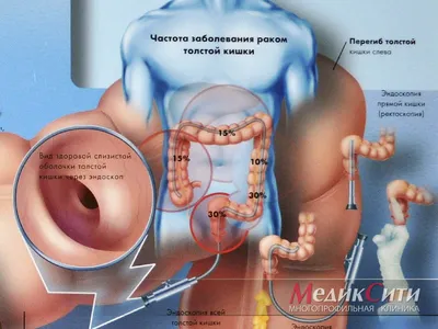 Толстая кишка человека: фотография для загрузки (JPG)
