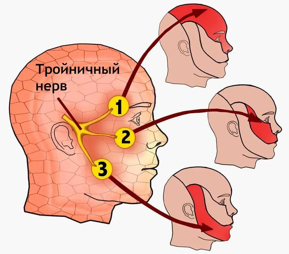 Головное предлежание плода