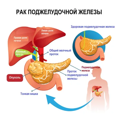 Поджелудочная железа: Возможности скачивания в JPG, PNG, WebP