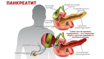 Уникальная фотография: Где находится поджелудочная железа?