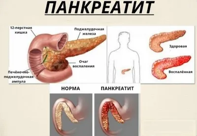 Высококачественная фотография: Местоположение поджелудочной железы