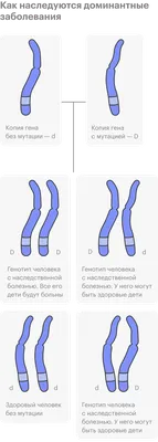 Картинка: Фото генетических патологий человека в PNG