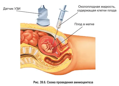 Картинка: Генетические мутации человека в формате PNG